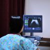 4D Ultrasonografi